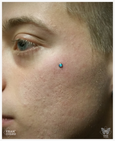 Fotografia di un viso di ragazzo con microdermal su zigomo di Industrial Strength con opale sky blu, eseguito da Francesco Deschino presso il Maia Tattoo di Milano Cornaredo